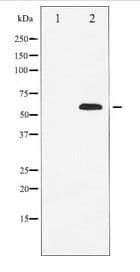 Polyclonal Rabbit anti-Human p56lck / LCK Antibody (WB)