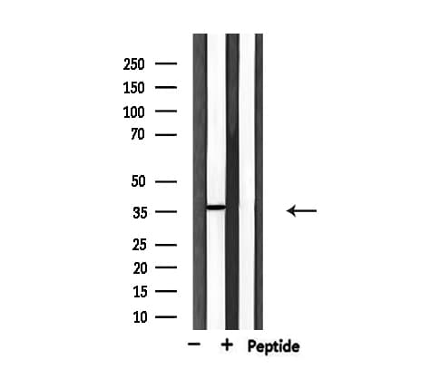 USF2 Antibody