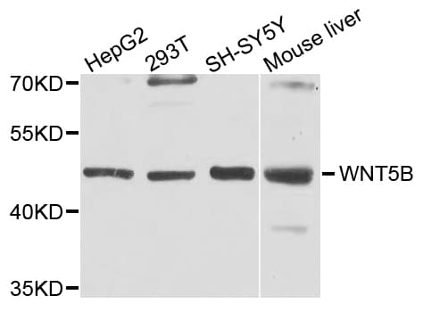 WNT5B Antibody