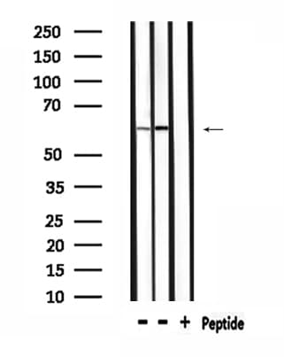 PPP2R5A Antibody