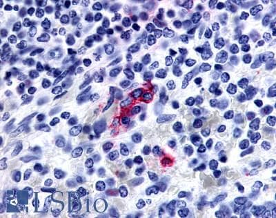 IHC-plus™ P2Y13 / P2RY13 Antibody (N-Terminus)