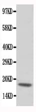 TNNC1 / Cardiac Troponin C Antibody (aa1-18)