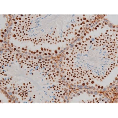 GATA1 Antibody (phospho-Ser142)