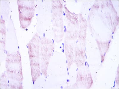 Monoclonal Mouse anti-Human OLIG2 Antibody (clone 1G11, IHC, IF, WB)