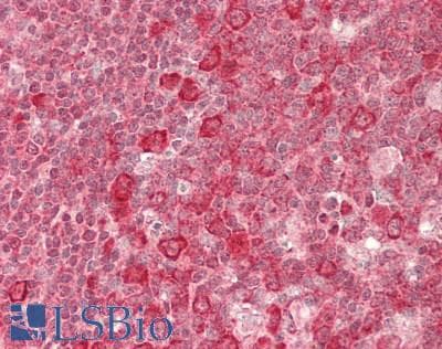 CHID1 Antibody (N-Terminus)