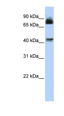 P2RX2 / P2X2 Antibody (aa36-85)