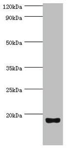 UTS2 / Urotensin II Antibody (aa35-124)