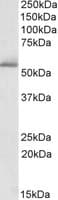 IHC-plus™ PDE1A Antibody (aa525-537)