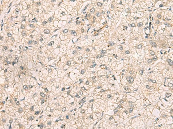 TTLL5 Antibody
