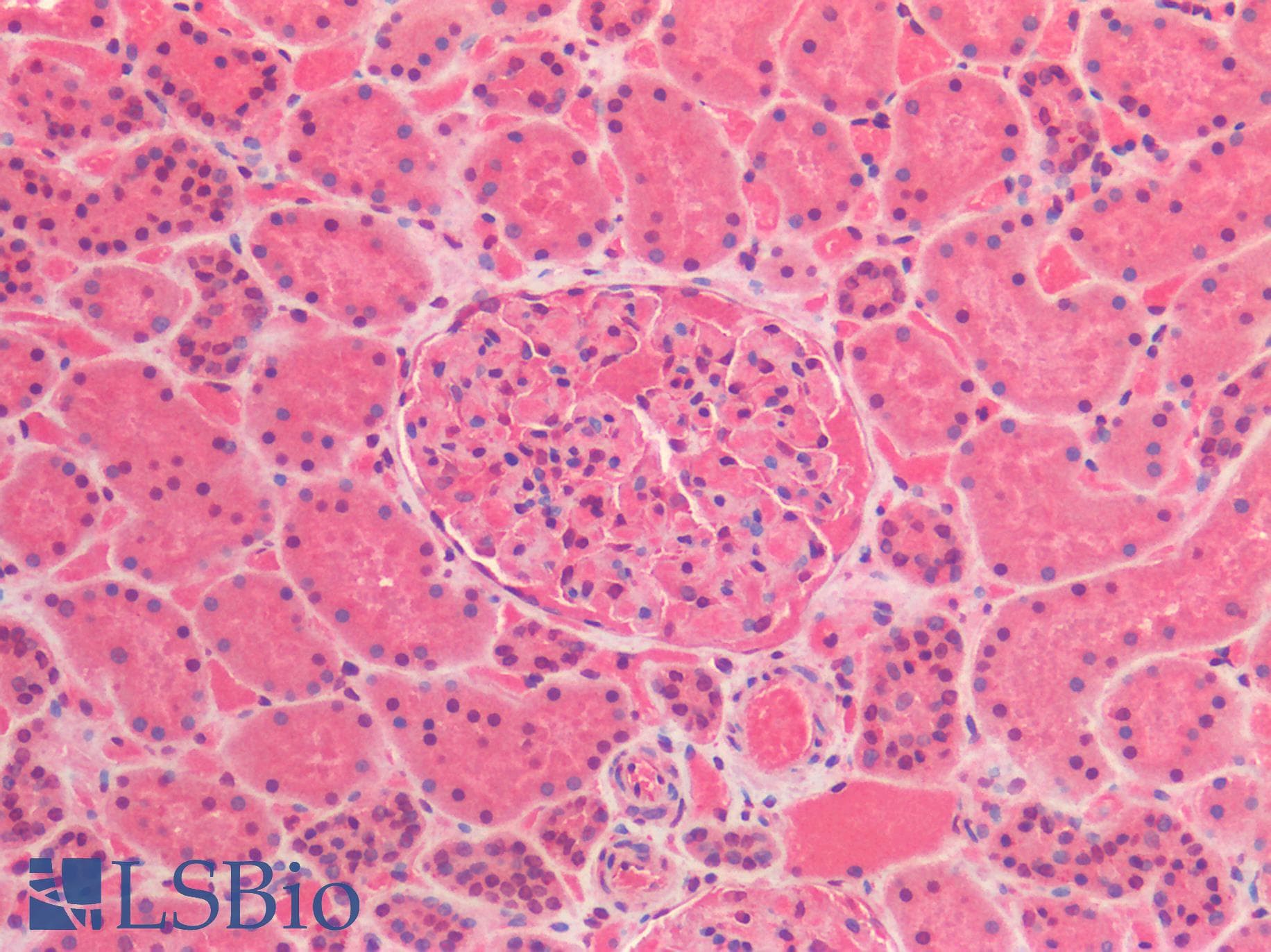 IHC-plus™ IL6 / Interleukin 6 Antibody