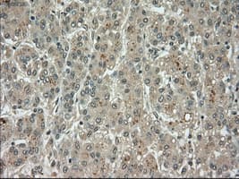 BUB1B / BubR1 Antibody (clone OTI3C7)