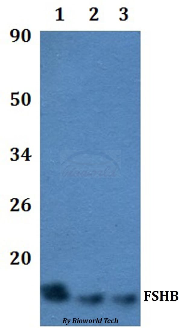 FSHB / FSH Beta Antibody