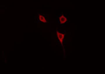 Polyclonal Rabbit anti-Human NTRK2 / TRKB Antibody (IHC, IF, WB)
