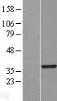 Human TRADD Protein (Over-Expression Lysate Myc-DDK (Flag))
