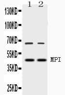 Mannose Phosphate Isomerase Antibody
