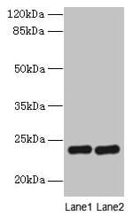 Polyclonal Rabbit anti-Human RD3 Antibody (IHC, WB)