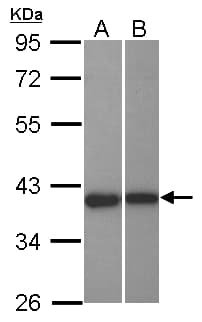 Polyclonal Rabbit anti-Human LRPB7 / LRRC23 Antibody (WB)