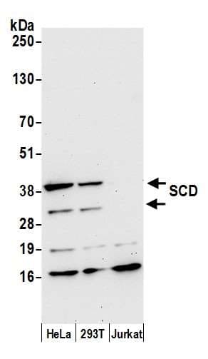 SCD1 / SCD Antibody (aa1-50)