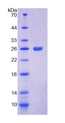 Mouse COASY Protein (Recombinant His-T7, N-terminus)