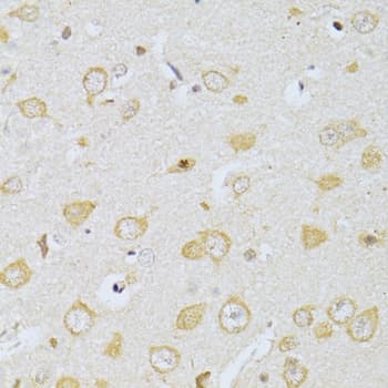 Polyclonal Rabbit anti-Human CHRNA7 Antibody (IHC, WB)