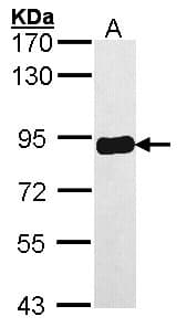 Polyclonal Rabbit anti-Human PRKCSH Antibody (aa1-283, WB)