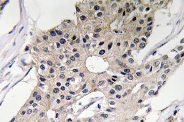 DEFA1 / Defensin Alpha 1 Antibody (aa3-52)