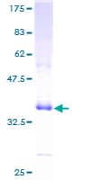 Human DEFA1 / Defensin Alpha 1 Protein (Recombinant GST)