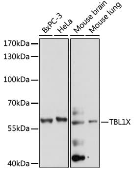 TBL1X / TBL1 Antibody