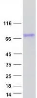 Human OTUD5 Protein (Recombinant Myc-DDK (Flag))
