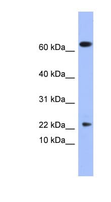 Polyclonal Rabbit anti-Human PLA2G5 Antibody (N-Terminus, IHC, WB)
