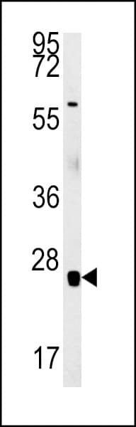 RBM24 Antibody (aa4-32)