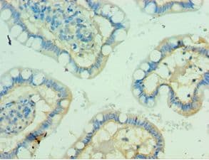 PVR / CD155 Antibody (aa220-345)