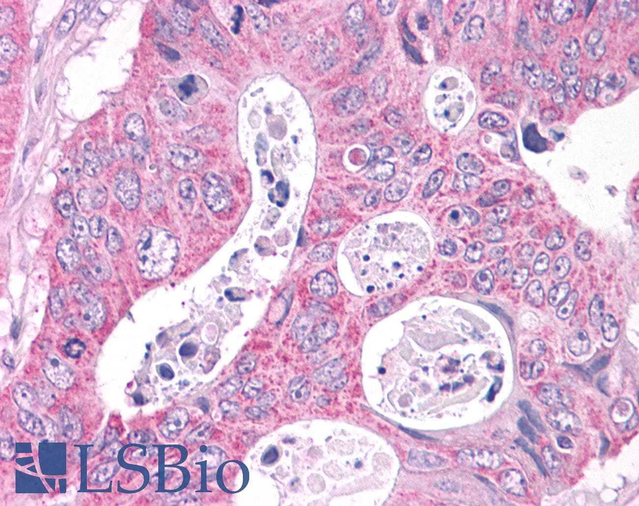 PathPlus™ NEK6 Antibody (C-Terminus)