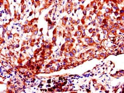 AKAP9 / YOTIAO Antibody
