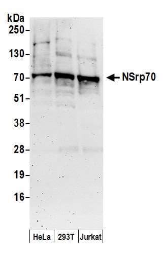 Polyclonal Rabbit anti-Human CCDC55 Antibody (aa350-400, WB)