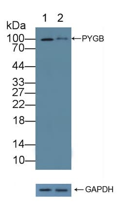 GPBB / PYGB Antibody (aa477-731)