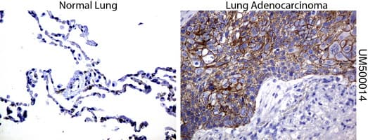 CTNNB1 / Beta Catenin Antibody (clone UMAB14)