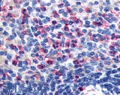 PathPlus™ FFAR2 / GPR43 Antibody (Extracellular Domain)