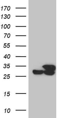PCMT1 Antibody (aa60-285, clone OTI2A9)