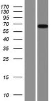 PIP5K1A Protein (Over-Expression Lysate Myc-DDK (Flag))
