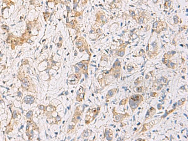 FYCO1 Antibody