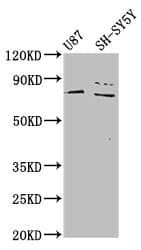 PARP7 / TIPARP Antibody