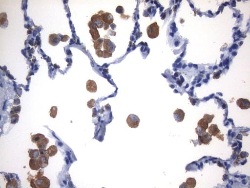 NAPSA / NAPA / Napsin A Antibody (aa64-244, clone UMAB213)