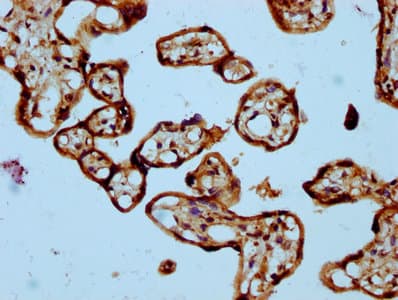 SASH1 Antibody