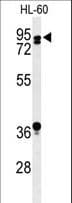 PATL1 Antibody (aa489-518)