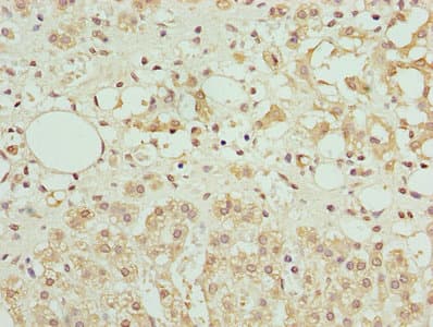 AZIN1 Antibody