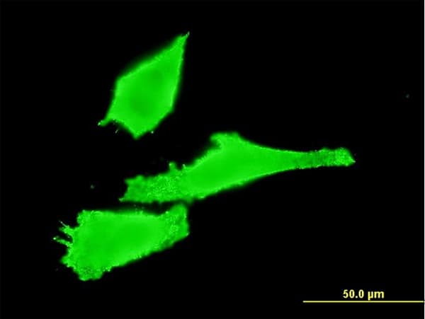 RAB42 Antibody (clone 3A2)