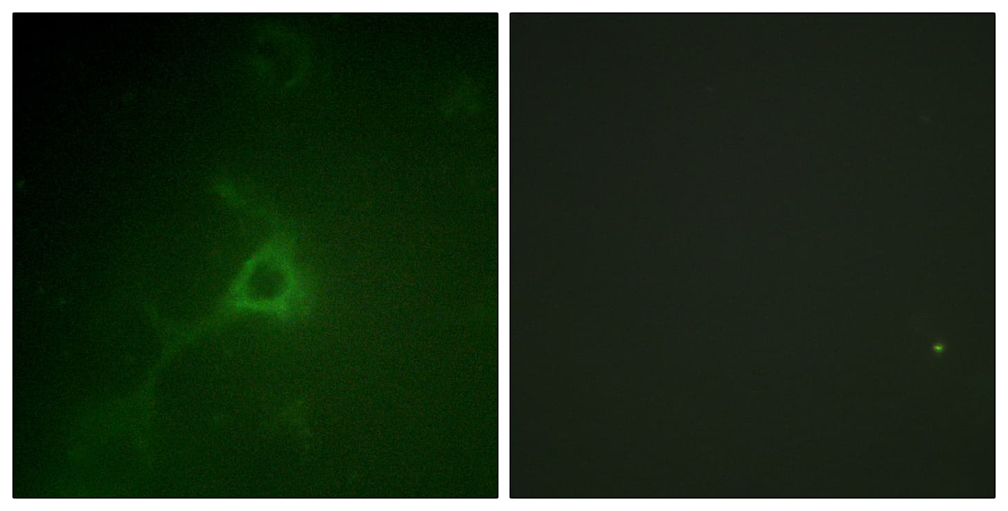 GFAP Antibody (aa11-60)