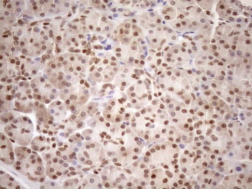 MGMT Antibody (clone OTI5A7)