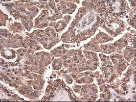 TRIM33 / TIF1-Gamma Antibody (clone OTI9D4)